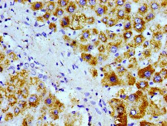 AGXT Antibody