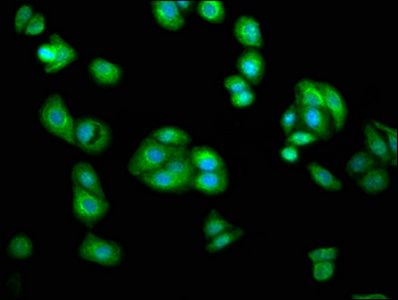 AGXT2 antibody