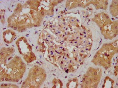 AGXT2 Antibody