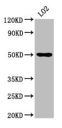 AGXT2 antibody