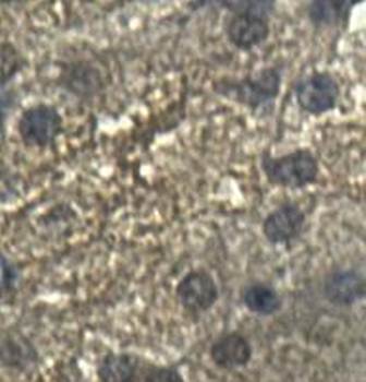 AGXT2 Rabbit Polyclonal Antibody
