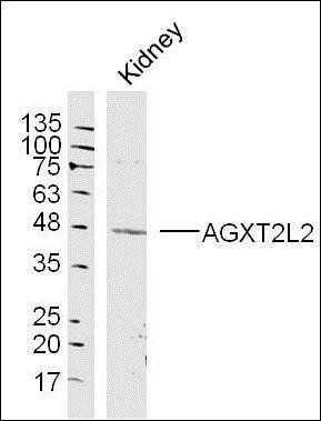 AGXT2L2 antibody