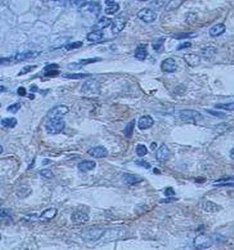 AHCYL1 Rabbit Polyclonal Antibody