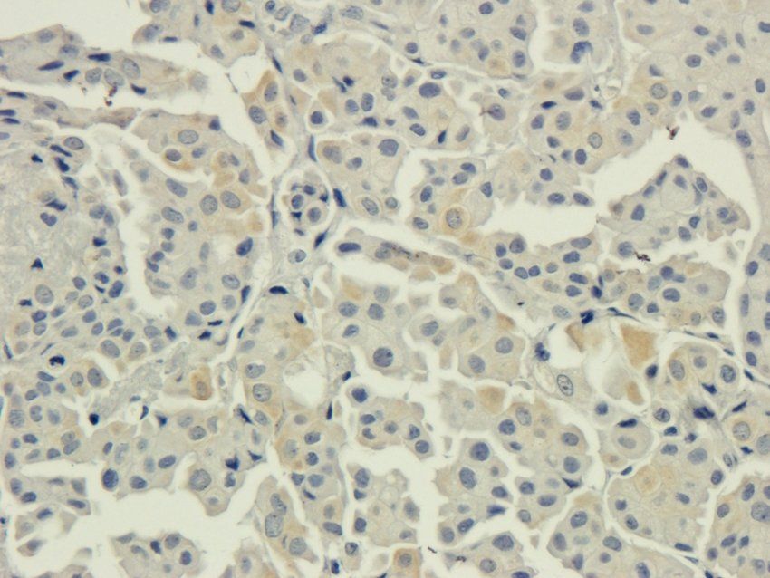 AHI1 antibody