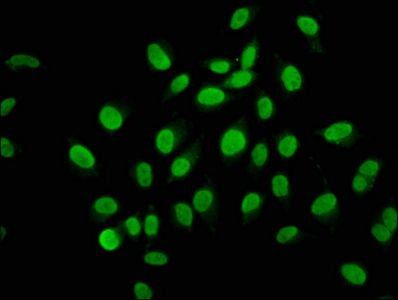 AHNAK2 Antibody