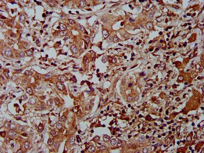 AHNAK2 Antibody