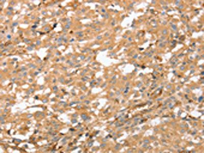 AHSG Antibody