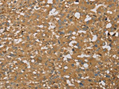 AHSG Antibody