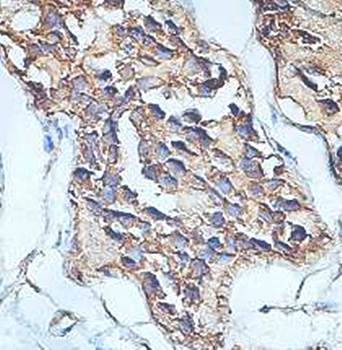 AIBZIP Rabbit Polyclonal Antibody