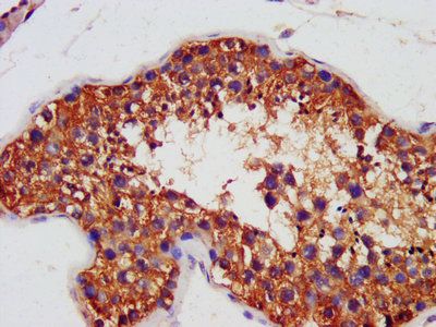 AIFM1 Antibody