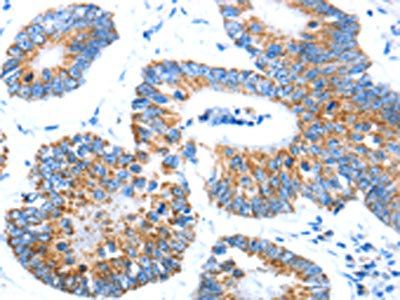 AIFM1 Antibody