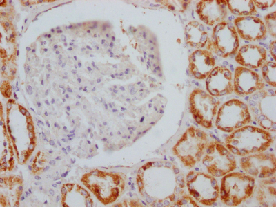AIFM1 Recombinant Monoclonal Antibody