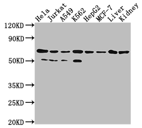 AIFM1 Recombinant Monoclonal Antibody