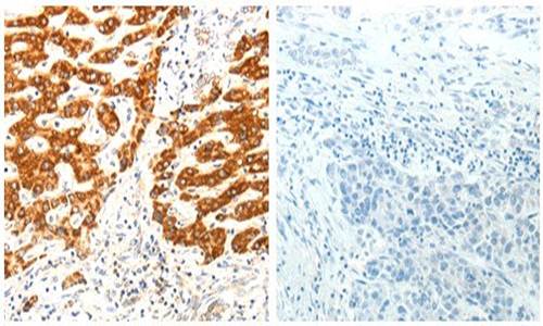 AIFM1 Antibody