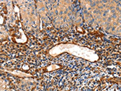 AIFM3 Antibody