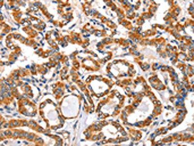 AIFM3 Antibody