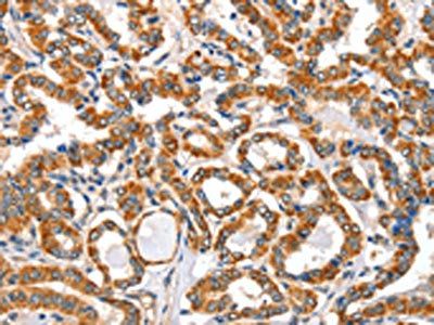 AIFM3 antibody