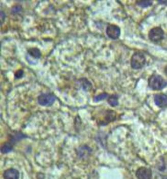 AIM1L Rabbit Polyclonal Antibody