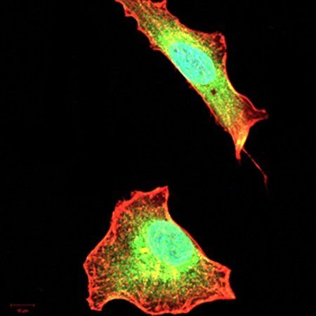 AIM2 Antibody