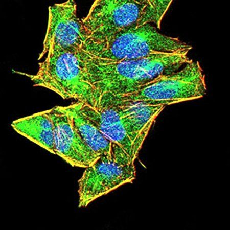 AIM2 Antibody