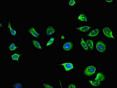 AIM2 Antibody