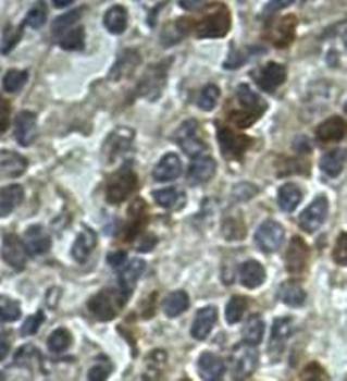 AIM2 Rabbit Polyclonal Antibody