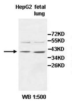 AIM2 Rabbit Polyclonal Antibody