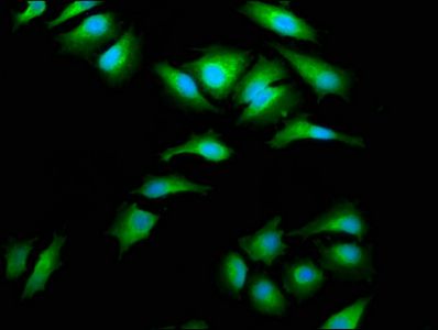 AIMP1 Antibody