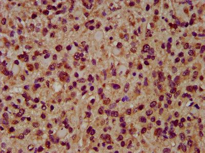 AIMP1 Antibody