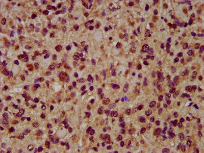 AIMP1 antibody