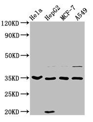 AIMP1 Antibody