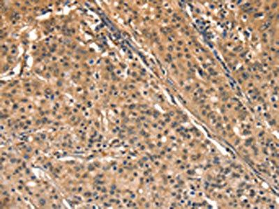 AIMP1 Antibody