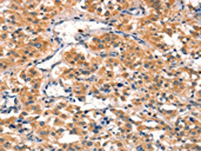 AIMP1 Antibody