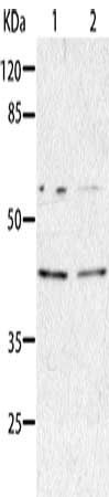 AIMP2 Antibody