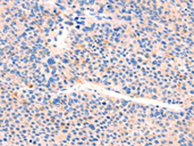 AIMP2 Antibody