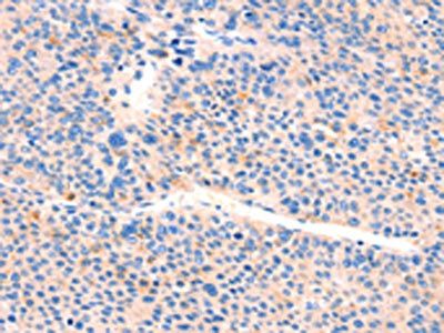 AIMP2 antibody