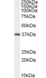 AIP/ARA9 Antibody