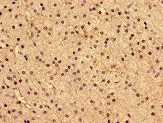 AIP Antibody