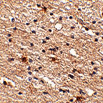 Aipl1 Antibody