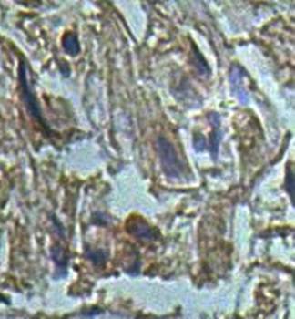 AIPL1 Rabbit Polyclonal Antibody