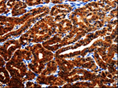 AK1 Antibody