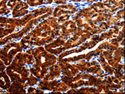 AK1 antibody