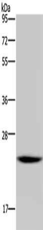 AK1 antibody