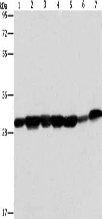 AK2 antibody