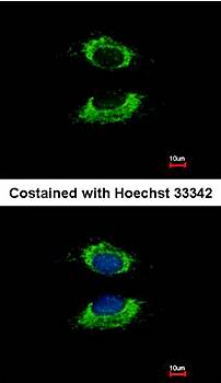 AK4 antibody