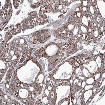 AK4 antibody