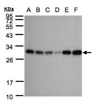 AK4 antibody
