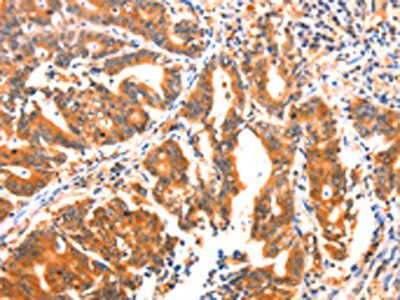 AK5 antibody