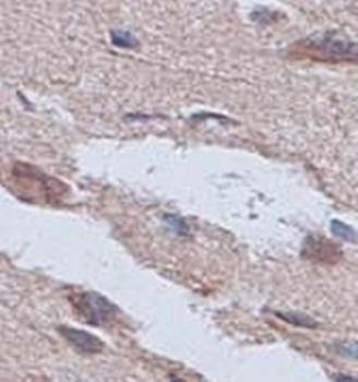 AK5 antibody