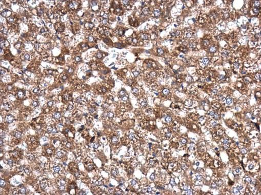 AKAP10 antibody [C3], C-term